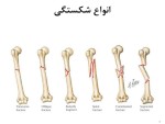 معرفی و دانلود جزوه ‌آسیب شناسی ورزشی‌ مینونژاد-1