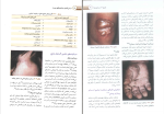 دانلود پی دی اف کتاب درسنامه بیماری های پوست حسین مرتضوی 414 صفحه PDF-1