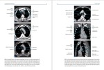 دانلود پی دی اف کتاب اصطلاح پزشکی آناتومی بدن ماسیمو سیلوا وسونیا فولسینیتی 220 صفحه PDF-1